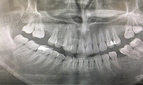 阜新市细河区品嘉口腔门诊部牙片