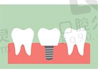 种植牙与真牙一样吗？求问给爸妈用登腾种植牙怎么样？