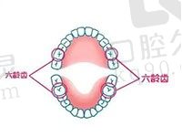 儿童六龄齿拔了对身体有影响，来看拔掉六龄牙的危害