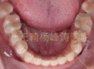 唐山牙博士矫正牙齿怎么样，从网友在几位正畸医生矫正牙上的经历来看