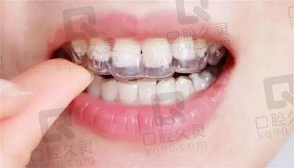 北京丽都医疗美容口腔医院牙齿矫正靠谱吗，给你看看我的牙齿矫正经历你便知道