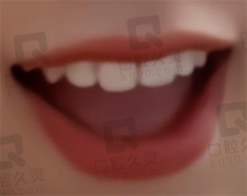 郑州仁和口腔牙齿矫正亲身经历后发现:仁和口腔矫正牙还是蛮靠谱的