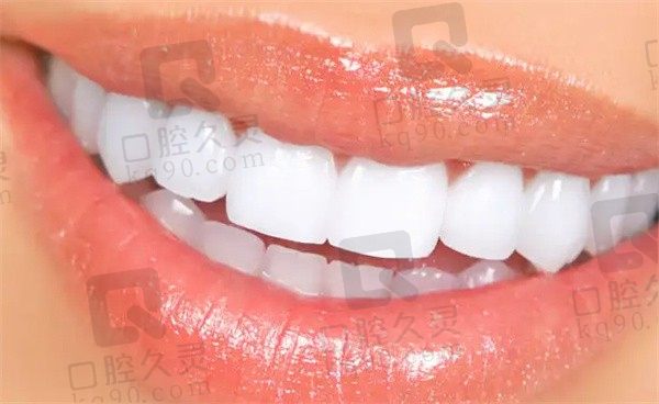 福建漳州齿恒口腔门诊部补牙项目真可以，坚固耐用用起来真不错