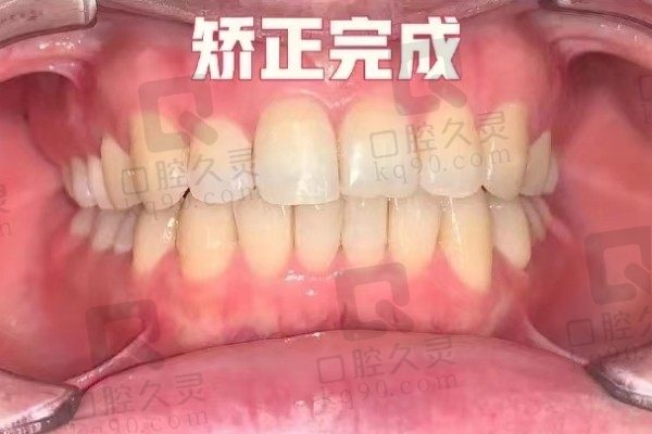 上海博信口腔门诊部怎么样？戴了隐形牙套正畸医生很靠谱