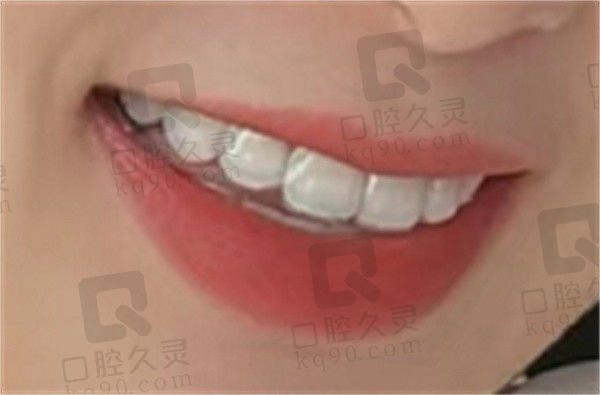 上海名冠口腔门诊部怎么样，网友亲历觉得矫牙设备先进服务周到