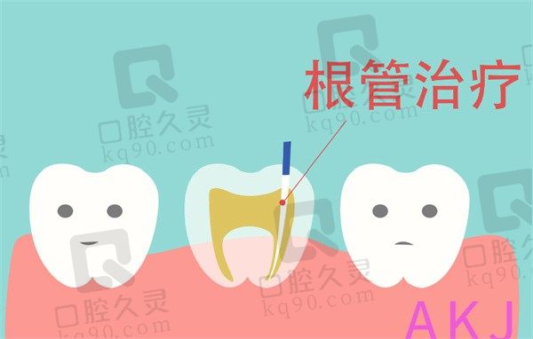 什么样的情况下必须做根管治疗，根管治疗多少钱一颗