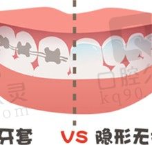 重庆江北区牙齿矫正价格贵不贵？这里查询2022全新整牙价目表