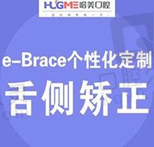 曝光青岛哈美口腔正畸医生技术，高难度eBrace舌侧矫正63000元起