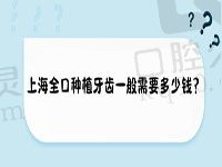 上海全口种植牙齿一般需要多少钱？快看上海全口种植牙的费用及推荐医院