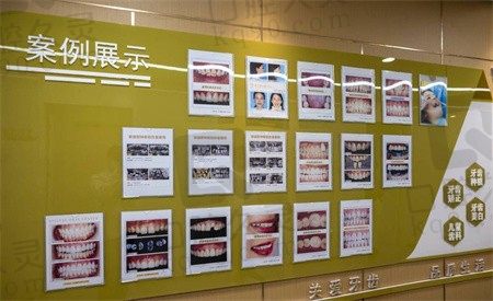 病例展示墙