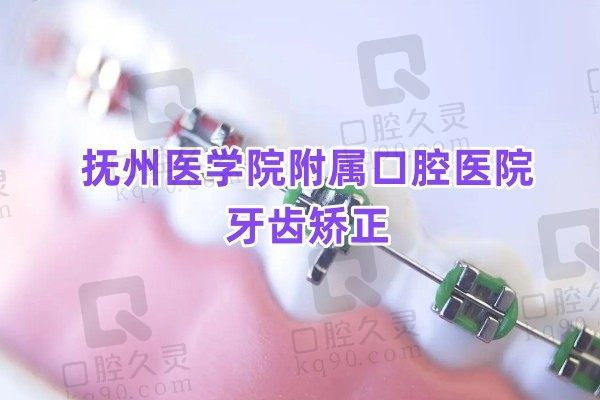 公布抚州医学院附属口腔医院牙齿矫正价格！自锁矫正1万元起