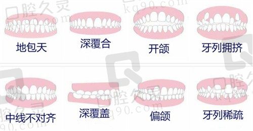 测评潍坊牙齿矫正比较好的医院，这几家正畸价格实惠技术好