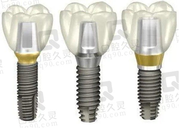 韩国登腾种植牙+全瓷牙冠价格仅2500元,是因寿命短才便宜吗