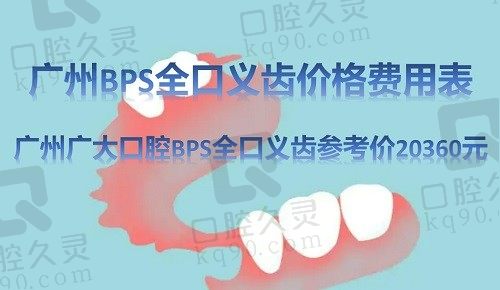 广州BPS全口义齿价格费用表（广州广大口腔BPS全口义齿参考价20360元）