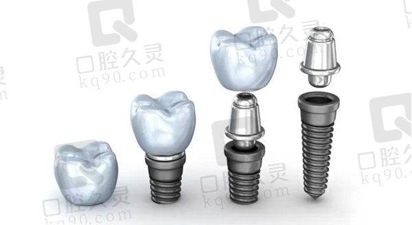 请问广州现在补牙/种牙有医保报销吗？分享可刷医保医院名单