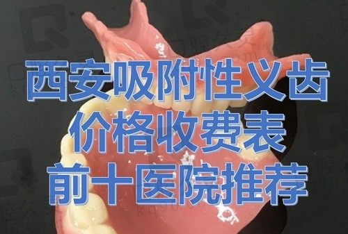 西安吸附性义齿价格费用一览表（西安小白兔口腔医院吸附性义齿参考价5380元）