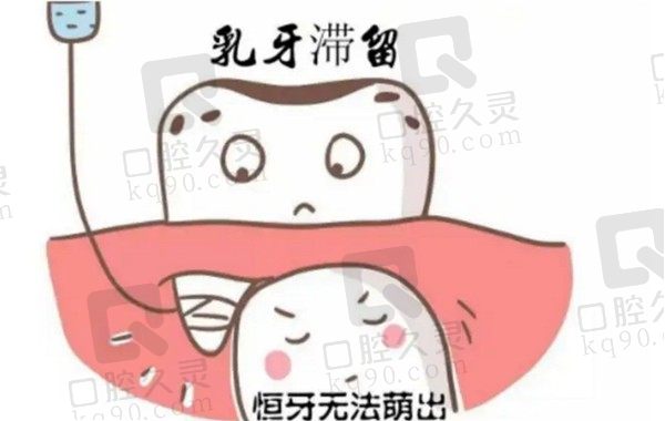 乳牙滞留应该怎么办？乳牙滞留拔除后恒牙可以回正常位置吗？