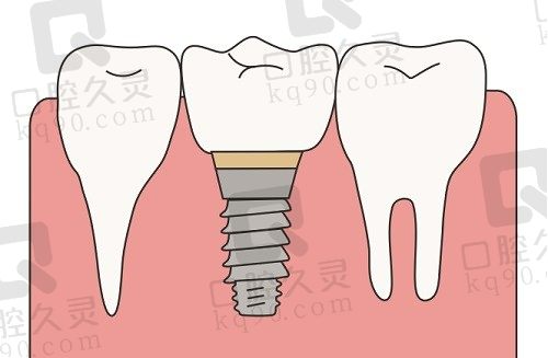 上海静安区牙科医院排行榜，排名前三的牙科机构口碑好收费实惠