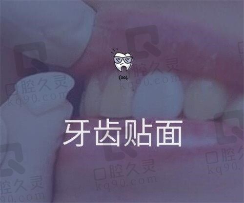 北京牙齿贴面医院有哪些?劲松/马泷/维乐牙贴面技术好排前三！