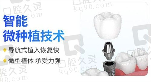 杭州金铂利口腔种植牙经历分享,微创种植牙技术在线体验感满分