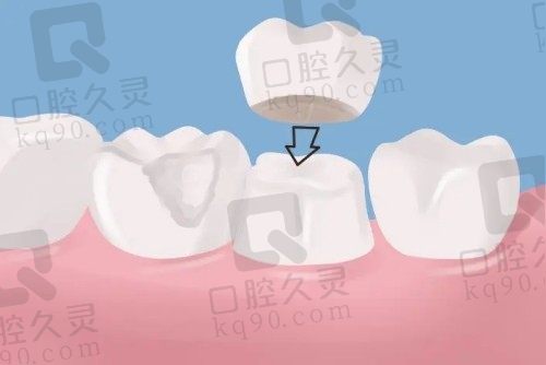 南阳种植牙多少钱一颗?参考植得、精益、牙博仕口腔种牙价格瞬间秒懂