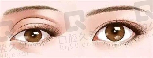 常秀芬医生怎么预约?做眼部整形到唐山金荣整形在线预约挂号