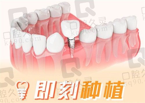 惠州新惠口腔医院种牙费用5880元起一颗,用的是瑞士ITI种植体
