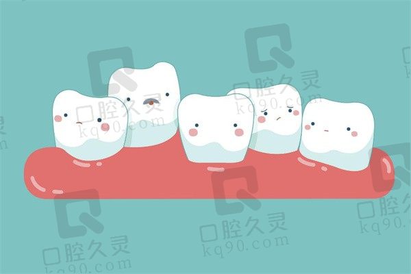 乳牙松动了是拔掉好还是自己脱落好？一般到什么程度才能拔？