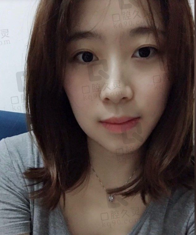 佩琪