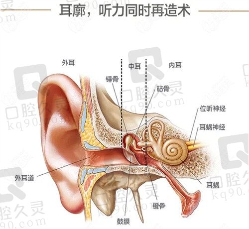 余文林做耳再造怎么样?扩张法耳再造5.5w起费用不贵预约率超高