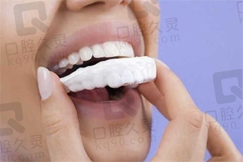 南昌诺德口腔种植牙价格：韩国登腾特斯种植牙首颗仅980元起