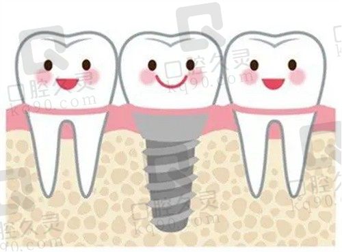 成都新桥口腔医院种牙怎么样？多种种植技术有保障，附种植牙价格