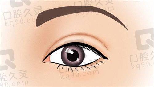 温科磊双眼皮做的怎么样?眼综合案例反馈双眼皮技术高超口碑好