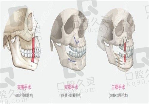 张立天磨骨怎么样?个人资料简介显示张立天磨骨技术好案例多