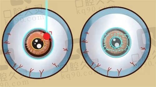 佳木斯爱尔眼科医院怎么样?口碑好价格透明附近视手术价格