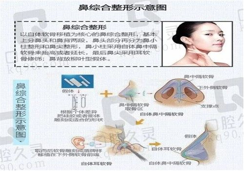 郑州姜南做鼻子的好吗?看医生简历就知道姜南鼻整形技术好口碑在线