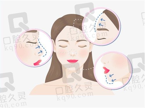 上海范荣杰做鼻子咋样?案例证实高难度鼻修复不翻车,风格自然不易留疤!