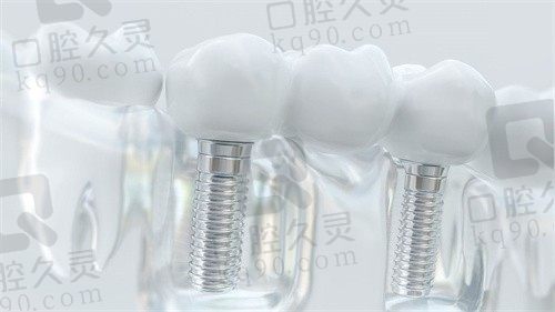  福州威斯登口腔医院瑞典Astra种植牙6800元起一颗，郭艳医生种牙稳固！