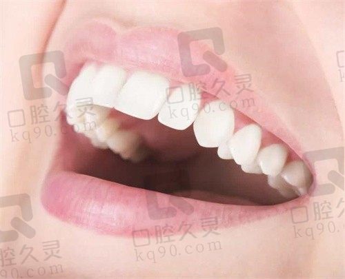 运城运中口腔医院种植牙怎么样?种植牙成效好寿命长价格实惠很放心