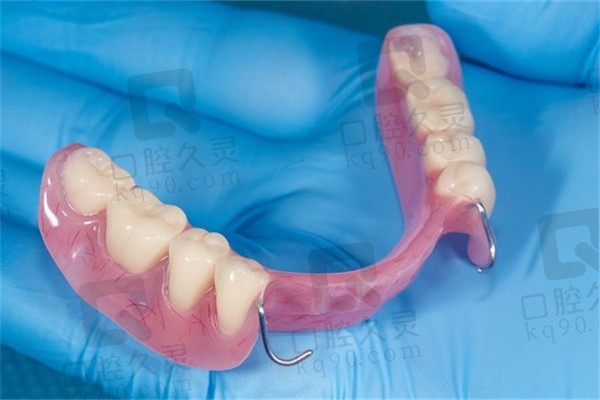 科普可摘局部义齿的组成部分是哪些？更有数字化制作流程分享