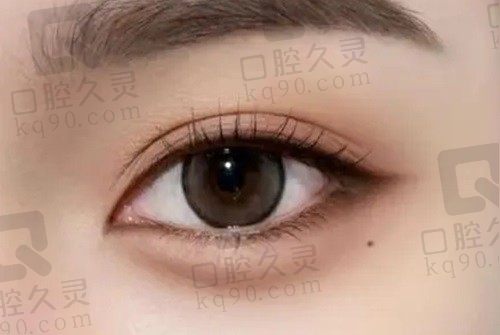 郑州缔莱美杨胜发做双眼皮怎么样?这些双眼皮技术及范例值得一看