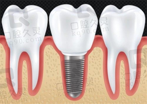 合肥泰康拜博口腔医院地址在哪?附电话及网友评价,这家口腔医院靠谱吗?
