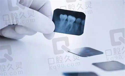 滨州牙博士口腔医院是正规医院吗?正规牙科地址在滨城区有价格来看