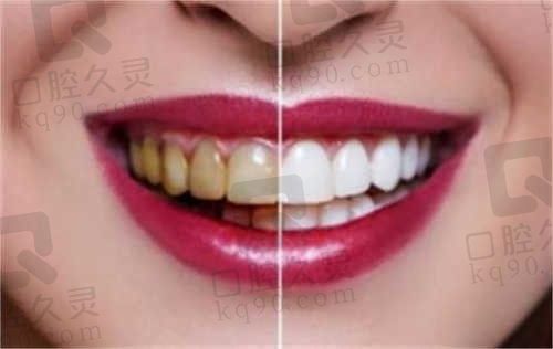 玉溪百信医院口腔科怎么样?技术娴熟,正规靠谱,口碑评价好