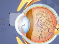 郑州博爱眼科近视手术摘镜成功，全飞秒全攻略小白必看！