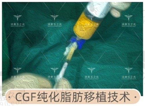 王明利医生做脂肪填充好吗？特色CGF纯化脂肪移植技术大获好评