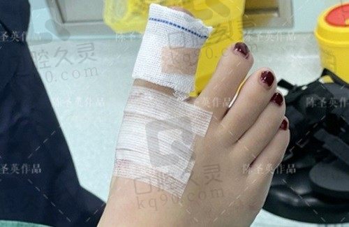 大脚骨医生苏敬达怎么样?经验技术都很强,做大脚骨手术性价比高