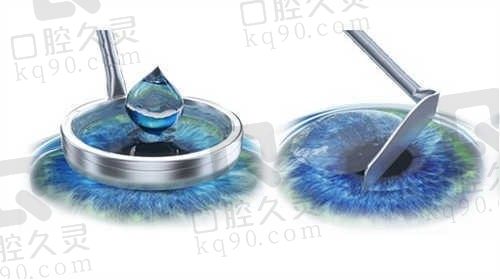这份泰州张勤眼科价目表请查收,近视/白内障/配镜等价格全都有