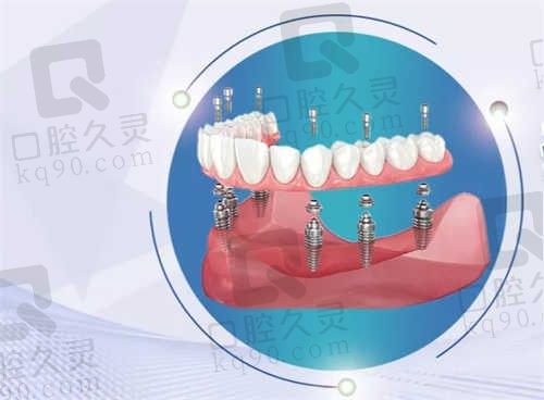 温州龙港牙贝恩口腔门诊部怎么样?价格透明,经验多,口碑佳!