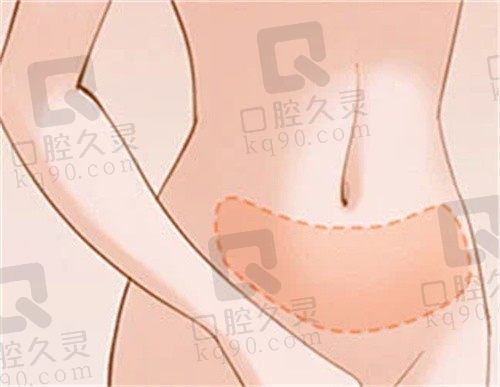 北京纯脂医疗美容医院价格表公布:单部位吸脂冯斌2W/王自谦1.39W/张春艳6.9K!